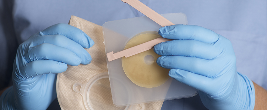 Am I at Risk of Colorectal Cancer?