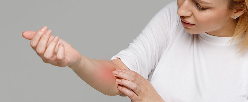 How Long Do Skin Rashes Last?