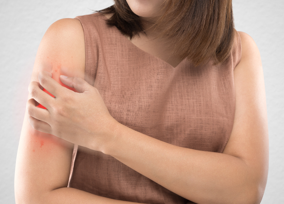 Can Tanning Beds Help Treat Psoriasis Safely?