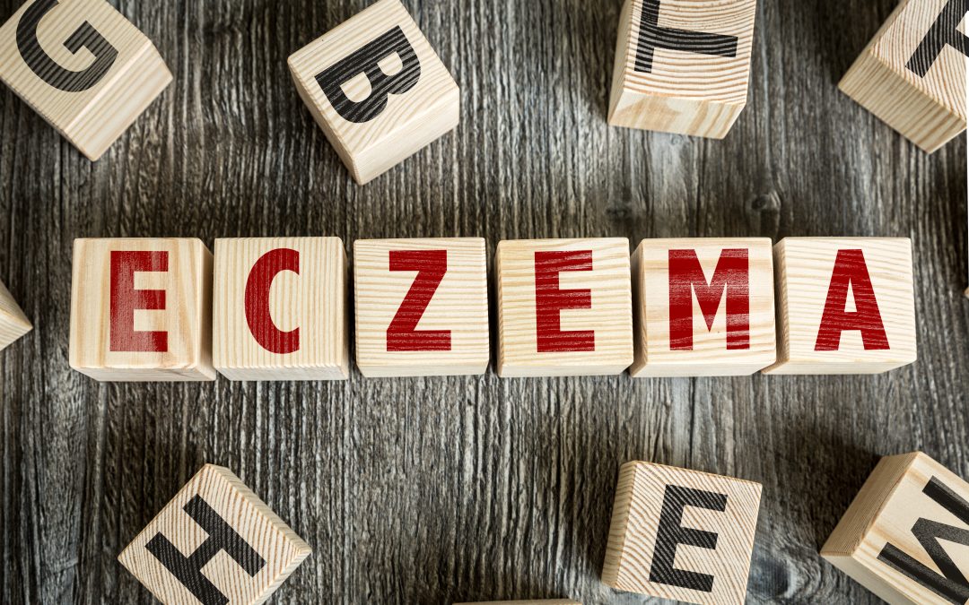 How Can I Know If I Have Psoriasis or Eczema?